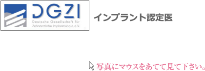 インプラント認定医